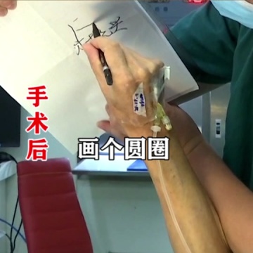 特发性震颤