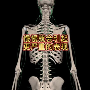 腰间盘突出