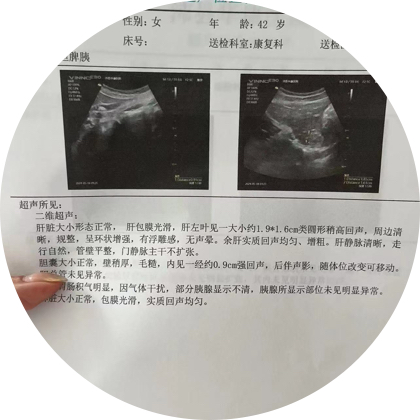 胆囊结石胰腺炎交流心得 群聊头像