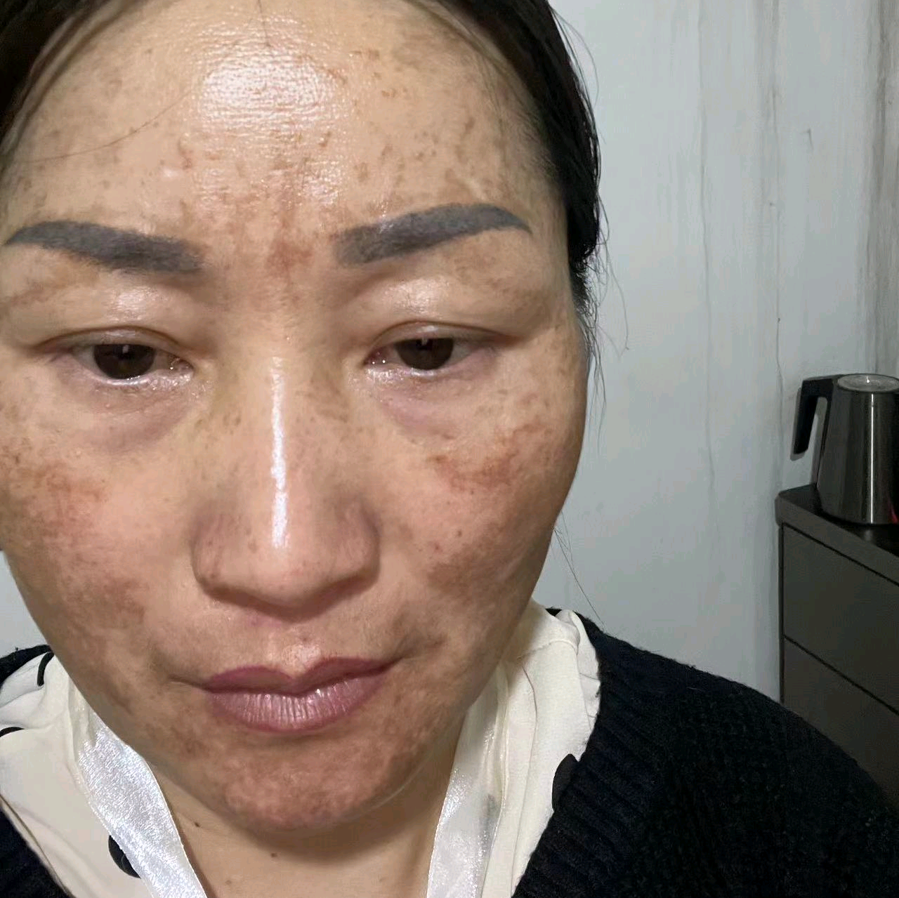 淡斑交流群 群聊头像